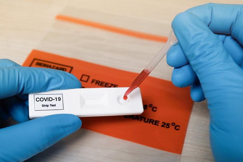 Covid19. Tests antigéniques en entreprises sous quelles conditions